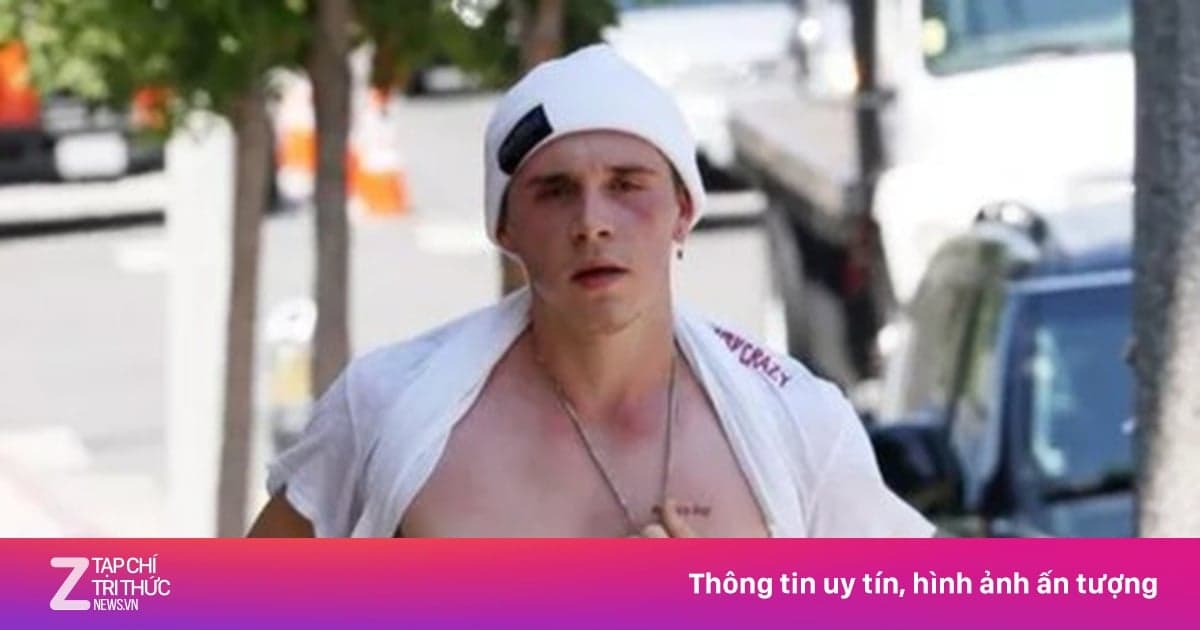 Brooklyn Beckham continues to ignore his parents.
