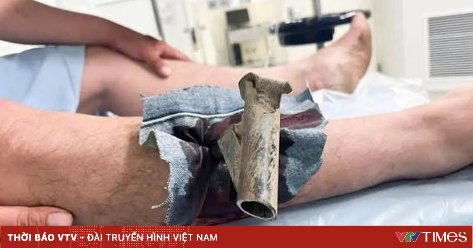 Cứu nam thanh niên bị chân chống xe máy đâm xuyên cẳng chân